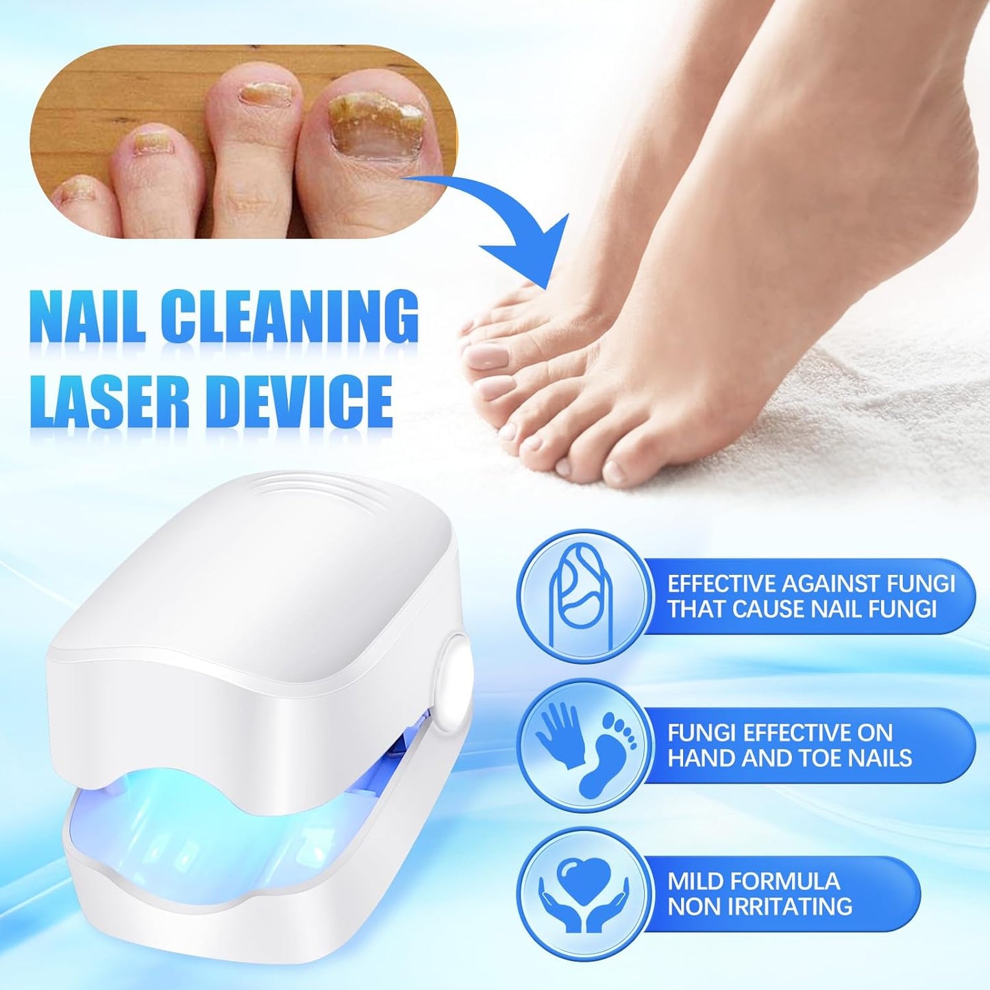 Rechargeable Nail Fungus Laser ? Anti-Fungal Device for Toenails, Hands & Feet (Home Use)