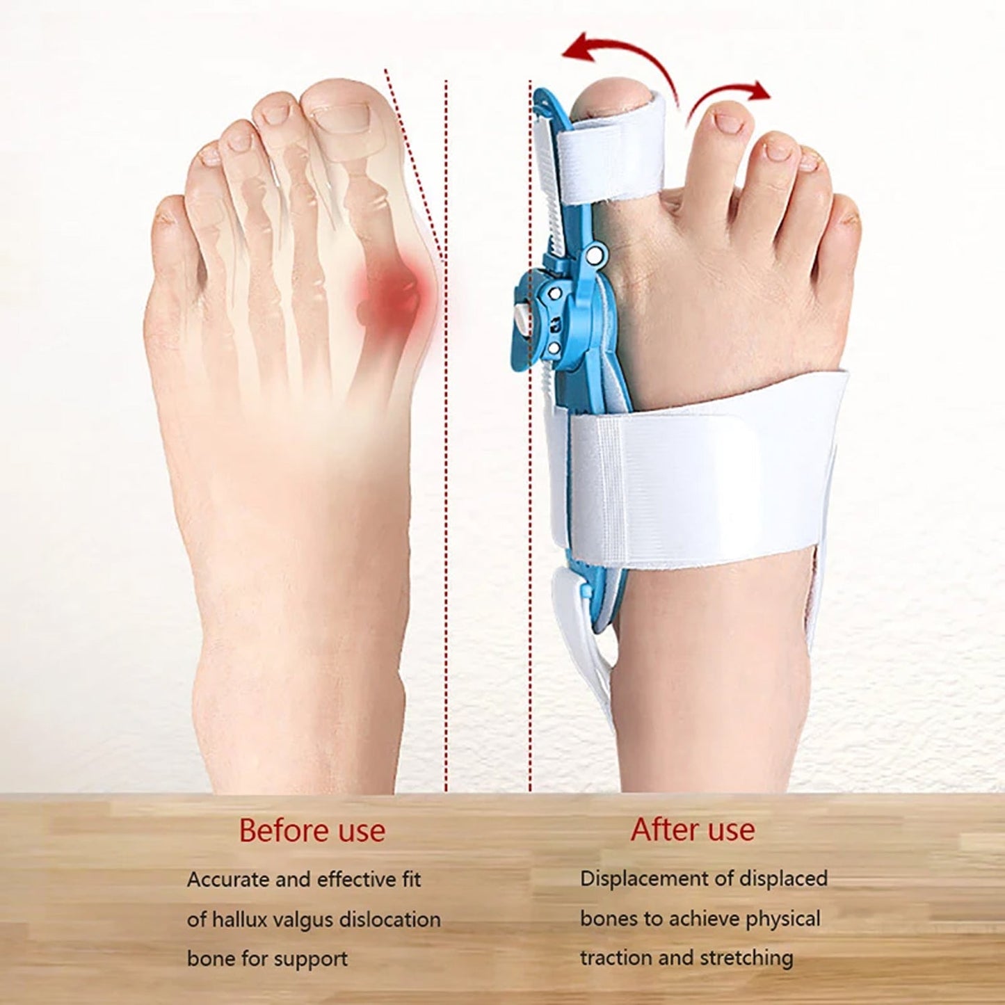 Adjustable Bunion Support Splint ? Hallux Valgus Corrector for Men & Women