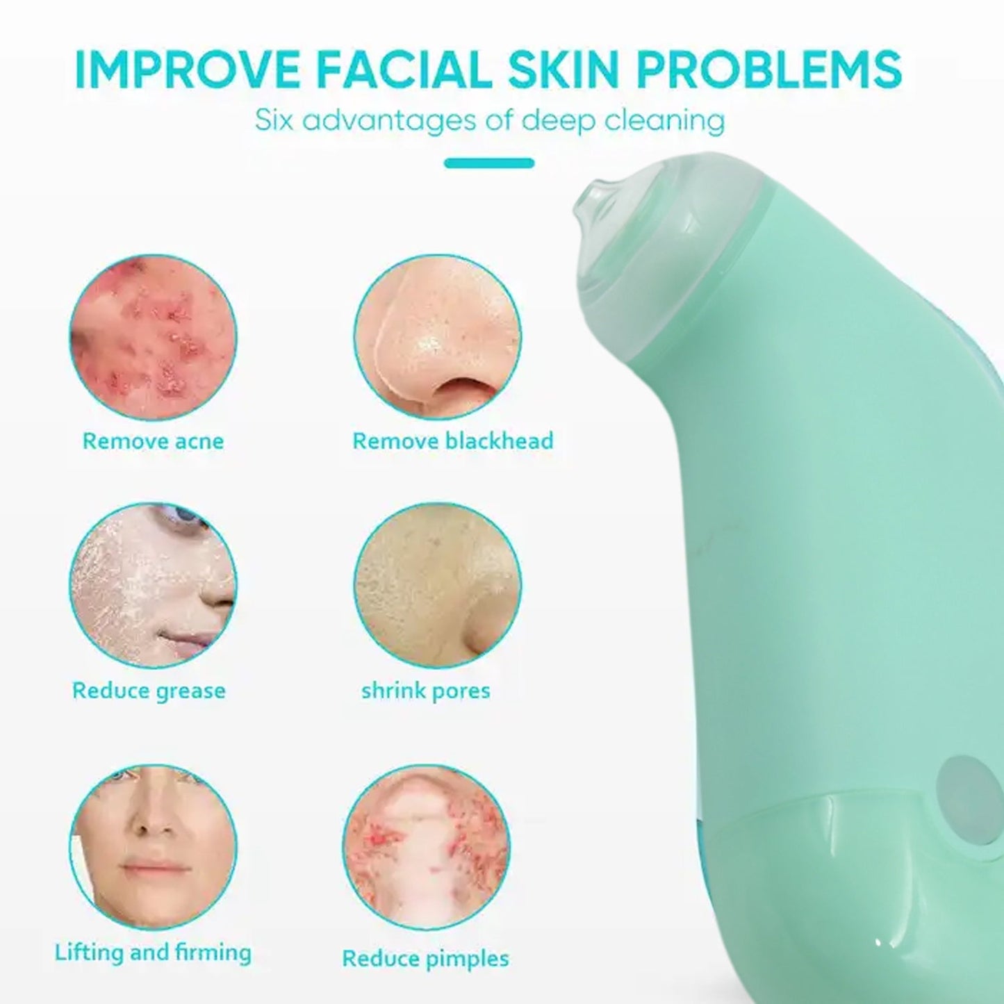 Mini Handheld Vacuum Blackhead Remover ? Facial Massage & Spot Lifting (1 Pc)