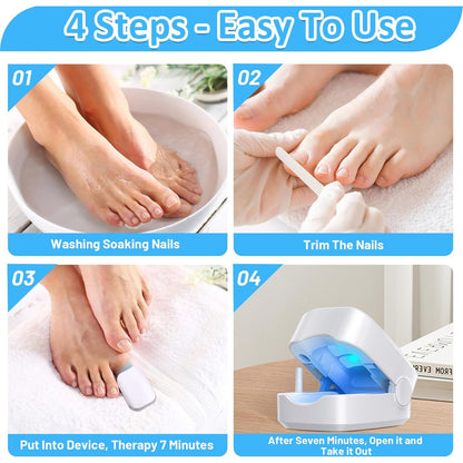 Rechargeable Nail Fungus Laser ? Anti-Fungal Device for Toenails, Hands & Feet (Home Use)