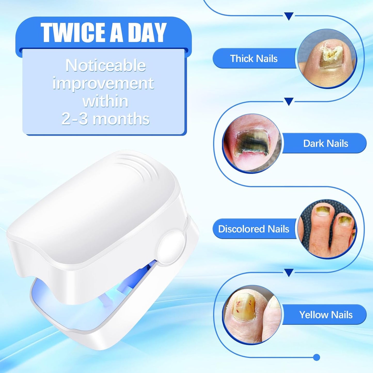 Rechargeable Nail Fungus Laser ? Anti-Fungal Device for Toenails, Hands & Feet (Home Use)
